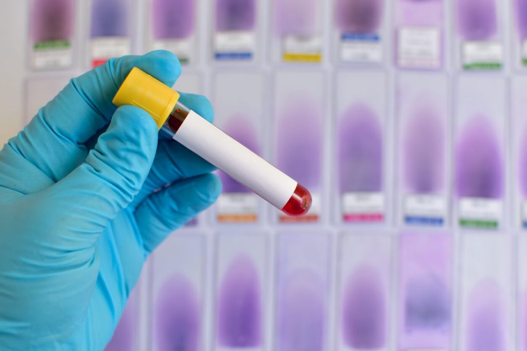 o que é doping